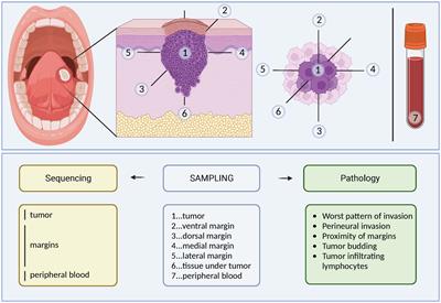 Enhancing oral squamous cell carcinoma prediction: the prognostic power of the worst pattern of invasion and the limited impact of molecular resection margins
